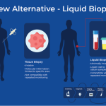 Liquid biopsies as a tool to combat prostate cancer